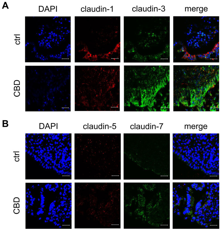 Immunofluorescent staining of follicle-associated epithelium within Peyer’s Patch (PP) after 6 h of incubation with 40 µM of CBD. (A) claudin-1 (red) and claudin-3 (green), as well as (B) claudin-5 (red) and claudin-7 (green). Nuclei were stained in blue (DAPI; n = 7; scale bar: 20 µm; representative images).