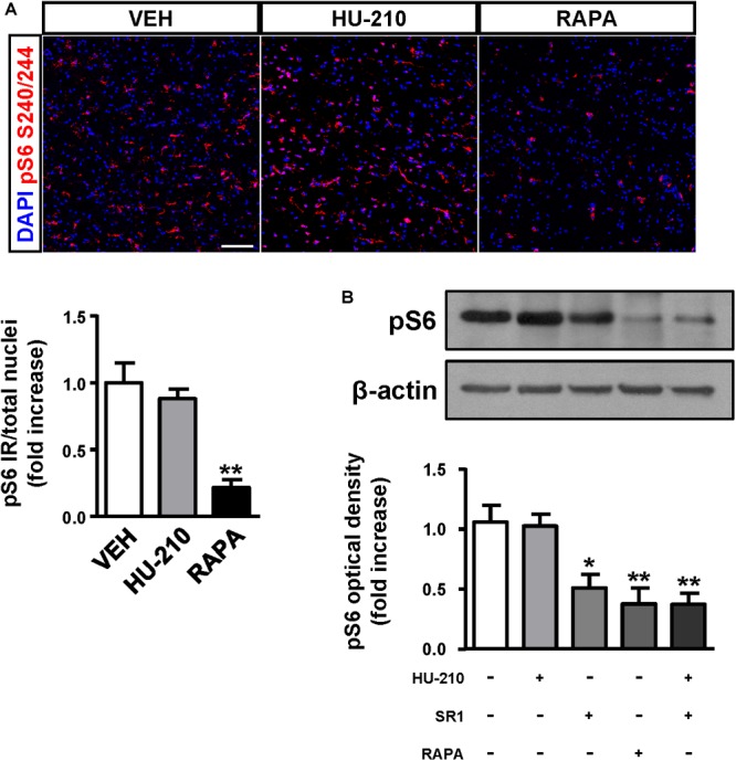 CB1 receptors blockade attenuates mTORC1 overactivation in FCD organotypic cultures. Organotypic cultures of FCD resections were cultured 7 days in vitro and exposed to the CB1 receptor agonist HU-210 (1 μM), and rapamycin (1 μM) 90 min. (A) Representative images of immunofluorescence characterization with phospho-S6S240/244 antibody were quantified and phosphoS6 immunoreactivity was referred to the total number of cells revealed by DAPI counterstaining. (B) Western blot analysis of phospho-S6S240/244 levels was performed in slice extracts after 90 min incubation with HU-210 alone or together with SR141716 (25 μM), SR141716 or rapamycin (n = 4 experiments). Statistical comparison versus vehicle samples, ∗p < 0.05; ∗∗p < 0.01. Scale bar: 80 μm.