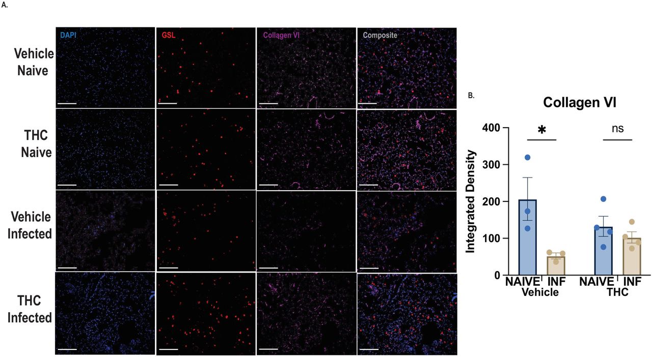 THC treatment is associated with retained lung Collagen VI following Nb infection.Lung extracellular matrix remodeling was assessed in vehicle and THC-treated naïve and Nb-infected mice. (A) Representative immunofluorescence images of lung sections stained for DAPI, GSL I, and Collagen VI. Scale bar = 20 µm. (B) Quantification of Collagen VI integrated density. Data are presented as individual animals with group means ± SEM. Statistical analysis was performed using two-way ANOVA with Tukey’s multiple comparisons test. *p < 0.05; ns, not significant.