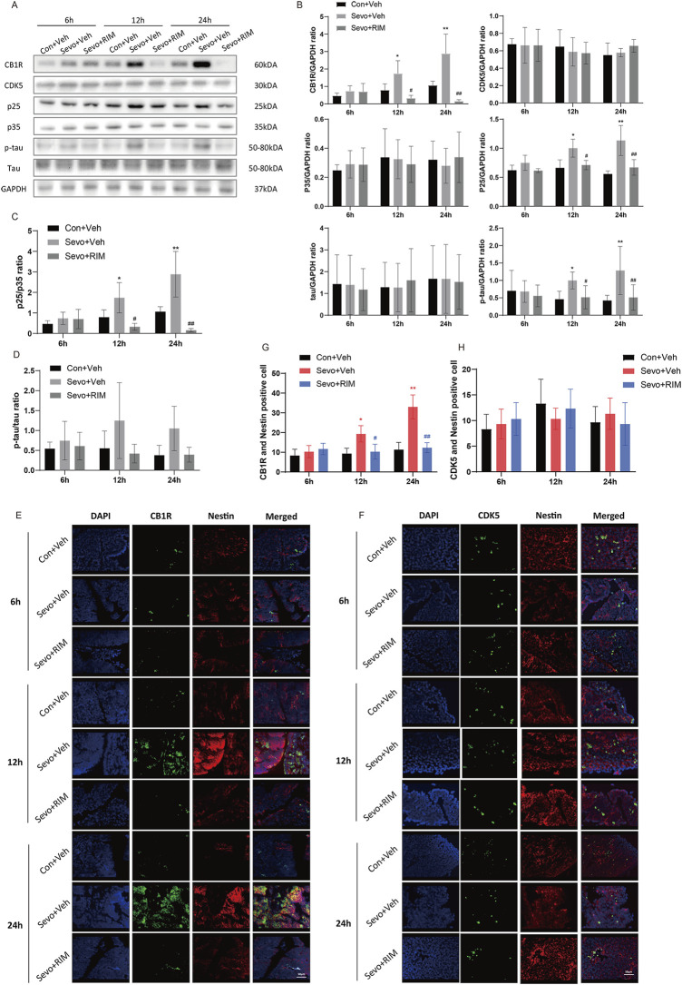 Sevoflurane upregulated p-tau in the fetal brains via the CB1R/CDK5/p25 pathway. Assays of western blotting (n = 3) demonstrating the expression of CB1R, CDK5, p35, p25, tau, and p-tau (A,B) and the value of p25/p35 (C) and p-tau/tau (D). Immunofluorescence double staining of CB1R and Nestin (E, n = 3) and CDK5 and Nestin (F, n = 3) in the fetal rat brains. Quantification of CB1R/Nestin-positive cells (G) and CDK5/Nestin-positive cells (H). Data are manifested as mean ± S.E.M. *p < .05, **p < .01, vs. the Con + Veh group; #p < .05, ##p < .01, vs. the Sevo + Veh group.