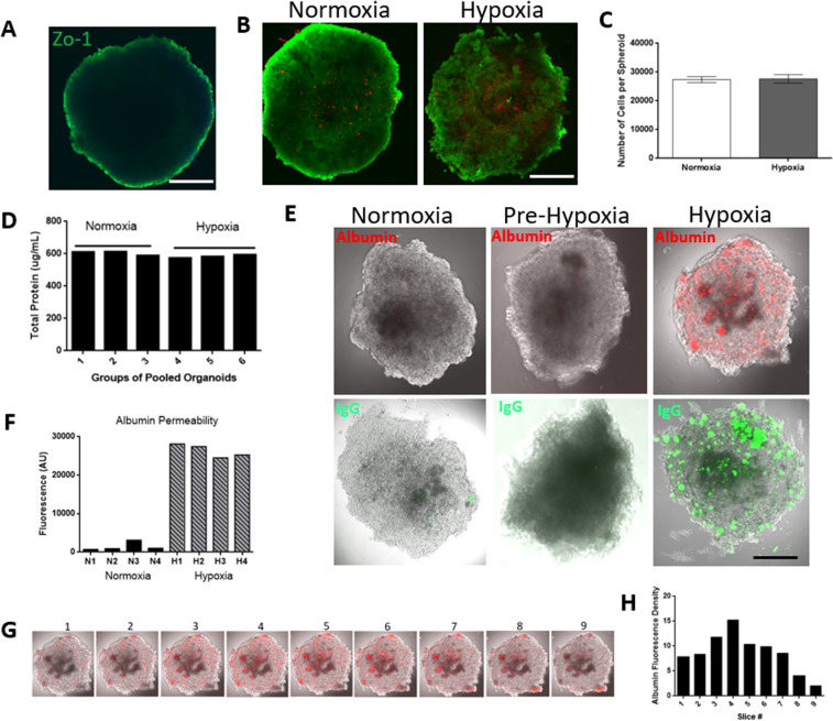 Hypoxia induced permeability and cell death. (A) Zo-1 staining around the organoid showing complete BBB coverage around the organoids. Cell viability was assessed using calcein AM (green- live cells) and ethidium homodimer 1 (red- dead cells) (B). The number of cells per organoid under both normoxic and hypoxic condition was determined by pooling 24 organoids into an eppendorf tube. Cell suspensions were obtained by dissociating the organoids with dispase. The cells were subsequently counted, and the data is shown in (C). Protein levels for six groups containing 80 organoids each were obtained from six randomly chosen plates and total protein levels were determined by BCA assay in (D). In (E), 10 organoids were used in each group and 5 randomly chosen organoids were imaged. The results show increased permeability of labeled albumin (red) and FITC labeled IgG (green) into organoids post hypoxic culture conditions compared to no penetration of these proteins under normoxic conditions. Pre-hypoxia represents organoids from the same batch that were pooled and assessed for albumin and IgG permeability prior to culturing under hypoxic condition. Images shown are middle slices of the z-stack confocal image. Fluorescence of albumin was quantified in 4 organoids under normoxic condition and post hypoxia as illustrated in F. (G) Shows the individual slices across the organoid and (H) the quantification of fluorescent albumin density from (E) within the organoid of each slice. Student T-Test, two tailed hypotheses, *P < 0.05. Data represented as mean \documentclass[12pt]{minimal} \usepackage{amsmath} \usepackage{wasysym} \usepackage{amsfonts} \usepackage{amssymb} \usepackage{amsbsy} \usepackage{mathrsfs} \usepackage{upgreek} \setlength{\oddsidemargin}{-69pt} \begin{document}$$\pm \,{\rm{SEM}}.$$\end{document}±SEM. Scale bars 200 μm.