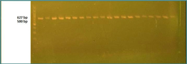 Electrophoresis of a 627 bp fragment of human CNR1 gene on ethidium bromide-stained agarose (1.5%) gel at 45 volt/cm2 and 1× TBE buffer for one hour