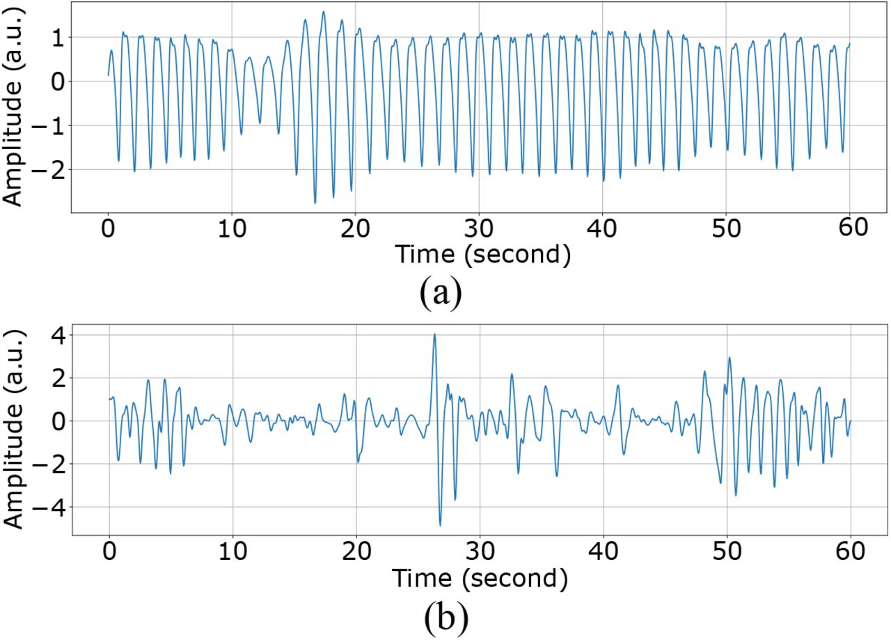 60-second PPG segments (a) clean (b) distorted by hand movements