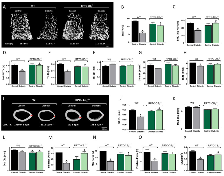 Nullification of CB1R in RPTCs protects against diabetes-induced bone loss. 3D images of the distal femoral metaphysis of RPTC-CB1−/− mice and their littermate WT controls with median bone volume fraction (BV/TV) values (A,B), bone mineral density (BMD; C), full bone BV/TV (D), trabecular thickness (Tb.Th; E), trabecular spacing (Tb.Sp; F), connectivity density (Conn.D; G), and trabecular number (Tb.N; H). 3D images of the femoral mid-diaphysis of mice with median values of cortical thickness (Ct.Th) for each group (I), cortical thickness (Ct. Th; J), medullary diameter (Med.Dia; K), diaphyseal diameter (Dia.Dia; L), stiffness (M), maximal force (N), fracture force (O), and moment of inertia (MOI; P). Data represent the mean ± SEM from 8–13 animals per group, * p < 0.05 vs. non-diabetic WT control mice, # p < 0.05 vs. diabetic WT mice.