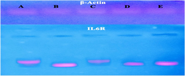 Gel electrophoresis of IL6R gene frequency concentration. Lane A, control; lane B, DOX; lane C, CBD; lane D, CBD + DOX; and lane E, TMZ + DOX