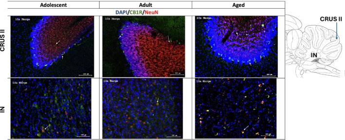Representative images of cerebellar expression of DAPI (blue), CB1R (green) and NeuN (red) in CRUS II and the interposed nucleus (IN).