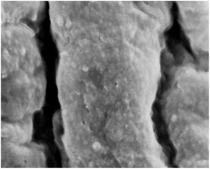 Loos of the endothelium from the luminal surface, longitudinal corrugations in the direction of blood flow caused by smooth muscle cells contractions in the tunica media with frequent fractures in the subendothelial layer.(Magnification 1700x).