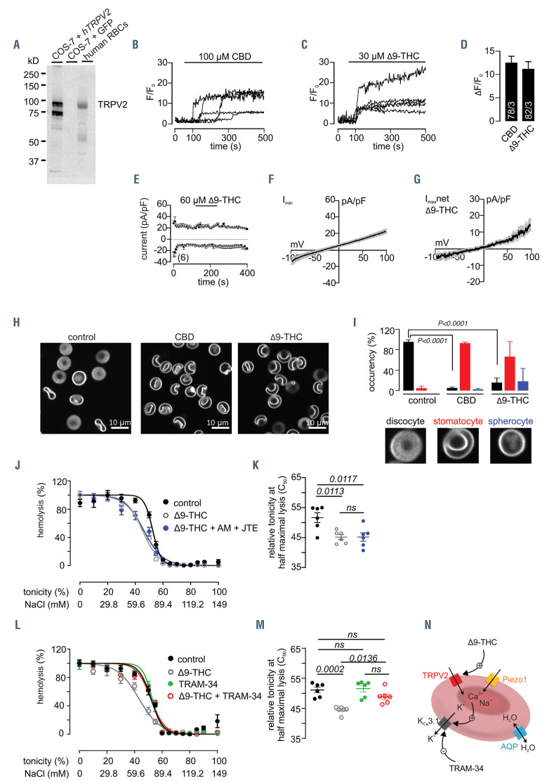 TRPV2 protein and function in human red blood cells. (A) Western blot of protein lysates of COS-7 cells transfected with human TRPV2 cDNA, the cDNA of green fluorescent protein (GFP) as a control, and human red blood cells (RBC) using anti-human TRPV2. (B, C) Representative traces of cytosolic Ca2+ changes, detected as Fluo-4 fluorescence (F/F0), in human RBC challenged by the application of 100 mM cannabidiol (CBD) (B) or 30 mM Δ9-tetrahydrocannabinol (Δ9- THC) (C). (D) Summary of the peak amplitudes in (B) and (C) as mean ± standard error of mean (SEM) (78 and 82 cells measured in 3 independent experiments each). (E) In- and outward currents at -80 and +80 mV in the absence and presence of Δ9-THC (black line) recorded from human RBC and plotted versus time. The corresponding current-voltage relationships (IV) of the basic current (Imin) and the peak net current in Δ9-THC (Imax net) are depicted in (F) and (G). Data are shown as mean ± SEM (number of cells indicated in brackets). (H) Confocal microscopic images of human RBC not treated (control, left) or treated with 100 mM cannabidiol (CBD, middle) or 30 mM Δ9-THC (right). (I) Bar graphs showing the percentage of discocytes (black), stomatocytes (red) and spherocytes (blue) as mean ± SEM, from three independent healthy donors, treated as in (H), with P-values calculated by one-way analysis of variance (ANOVA), followed by the Bonferroni multiple comparison. The classification was done with 3-D stacks of confocal images. (J) Hemolysis (%) of human RBC treated with the vehicle (control, black), 30 mM Δ9-THC (gray open circle) or 30 mM Δ9-THC in the presence of 100 nM CB1- and CB2-receptor antagonists AM251 and JTE907 (Δ9-THC + AM + JTE, blue) plotted versus the extracellular NaCl concentration (mM) and respective tonicity (%), with extracellular [Ca2+] kept at 76 mM as described in Figure 1F. (K) Tonicity at which 50% lysis occurred (C50), calculated by sigmoidal fitting of the individual experiments in (J). (L) Hemolysis (%) of human RBC in buffer A (149 mM NaCl, 2 mM CaCl2, 4 mM KCl, 2 mM HEPES, pH 7.4), treated with vehicle (control, black), 30 mM Δ9-THC (gray open circle), 2 mM TRAM-34 (green) or 30 mM Δ9-THC plus TRAM-34 (red) for 30 min, after 26-fold dilution in buffer B (0-149 mM NaCl, 2 mM CaCl2, 4 mM KCl, 2 mM HEPES, pH 7.4); extracellular [Ca2+] was kept at 2 mM. (M) Tonicity at which 50% lysis occurred (C50), calculated by sigmoidal fitting of the individual experiments in (L). Data in (K) and (M) are shown as means ± SEM from two independent experiments performed in triplicate with the P-value calculated by one-way ANOVA, followed by the Bonferroni multiple comparison. (N) Working model for how TRPV2, activated by Δ9-THC, modulates the TRAM-34 sensitive KCa3.1 activity in a human RBC. Note that TRPC6 was not detectable in human RBC.
