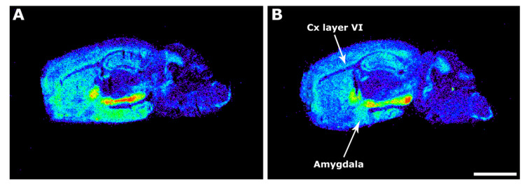 Representative autoradiograms of WT (A) and 3xTg-AD (B) mice in sagittal sections that show [35S]GTPγS binding stimulated by WIN55,212-2 (10−5 M). Note the decrease of the CB1–mediated activity at layer VI of the cortex (Cx Layer VI) and at the medial amygdala. Scale bar = 3 mm.