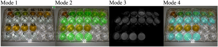 FI changes of bile collected from patients with T tubes at different time points after ICG injection using the NIRF imaging system. 0 h, bile collected from T tube before ICG injection; 2 h, 4 h, 8 h, 12 h, 16 h, 20 h, 24 h, 28 h, and 36 h, bile collected from T tubes 2, 4, 8, 12, 16, 20, 24, 28, and 36 h after ICG injection, respectively; C, control fluids containing both ICG and albumin (albumin concentration: 0.01 g/mL; ICG concentration: 0.01 mg/mL)