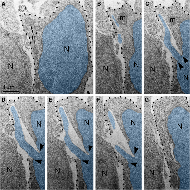 An example of plasma membrane rupture blocked by adjacent cell(A–G) Serial electron micrographs depict a neuron with PNH from the cortical plate of wildtype mouse embryo exposed to high dose (2.0 mg/kg) of CB1R agonist WIN 55,212-2. The nucleus and PNH stream are pseudo-colored blue. Points of interruption of NE are indicated with arrowheads. The plasma membrane is designated with dotted lines. Although the nuclear hernia produces a large rupture of the plasma membrane, the cellular cytoplasm does not show evidence of degradation and mitochondria do not show evidence of swelling. Scale bar in (A) is valid for all. Abbreviations: N, nucleus; m mitochondria.