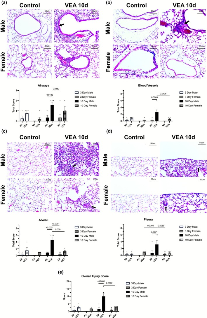 Hematoxylin and eosin staining of lung tissue from 10‐day control and VEA‐exposed mice reveals alterations to (a) airway peribronchiolar, (b) blood vessel perivascular, (c) alveolar, and (d) pleural spaces of the lung. Representative light microscopy images (control, left column; VEA 10 days, right column; male, top row; female, bottom row) display (a) a significant increase in cell aggregates (arrow) surrounding airways (peribronchiolar) in males; (b) heightened immune cell recruitment (arrow) around blood vessels (perivascular) in males compared to females; (c) alveoli air spaces with a significantly increased influx of focal agglomerates of leukocytes (arrow) in males compared to females; and (d) increased inflammation (arrow) in the pleural region in both males and females. All images were taken using a 20× objective lens. Semiquantitative histology scores of the lungs in male and female mice were completed by two independent observers following 3‐day and 10‐day exposure to VEA or to filtered air. This comprehensive analysis comparing 10‐day VEA‐exposed males and females to their respective controls revealed significantly increased (b) bronchiolar, (b) perivascular, (c) alveolar, (d) pleural inflammatory scores, as well as (e) a total lung injury score in males compared to filtered air control males. In contrast, no statistically significant increases in inflammation were present in VEA‐exposed females, compared to filtered air controls. These semiquantitative scores (severity × extent) could range from 0 to 9, while the overall lung injury (the combined scores from each of the four regions) could range from 0 to 36. Data is presented as mean score ± standard error (SE). N = 6/treatment group. VEA, vitamin E acetate.