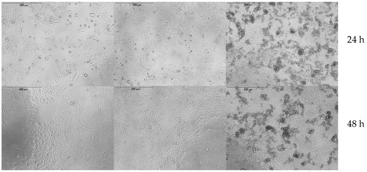Caco-2 cells under control conditions (left), incubated with Floradix® (middle), and incubated with IH-MPs (right). Upper row after 24 h; lower row after 48 h. No morphological changes were observed. Scale bar for all images, 500 µm.