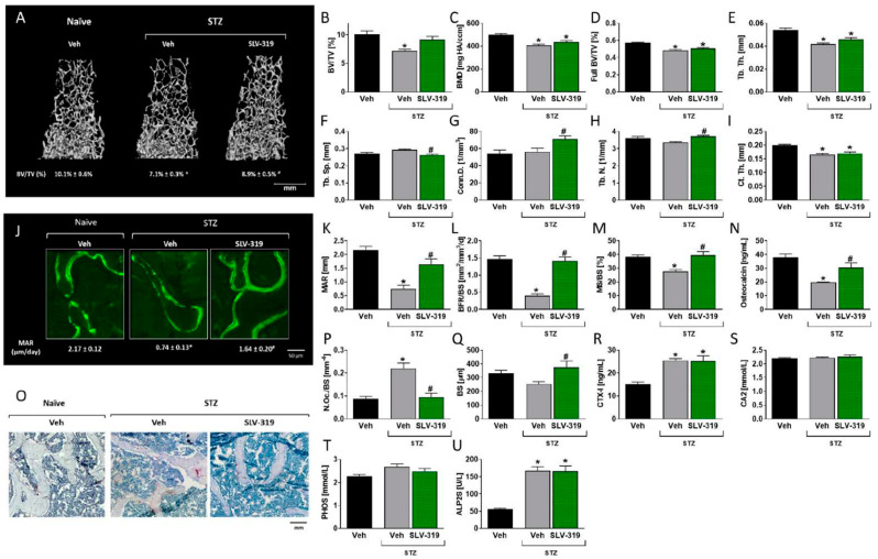 Chronic CB1R blockade prevents T1D-induced bone loss. 3D representative images of the distal femoral metaphysis of mice with median bone volume density (BV/TV) values (A,B). Bone mineral density (BMD; C), full bone BV/TV (D), trabecular thickness (Tb.Th; E), trabecular spacing (Tb.Sp.; F), connectivity density (Conn.D; G), trabecular number (Tb.N; H), and cortical thickness (Ct.Th; I). Histomorphometric and biochemical analysis of bone remodeling parameters reveals a rescue of diabetes-induced bone loss by SLV-319. Representative images of calcein-labeled mineralized fronts (J), the mineral apposition rate (MAR; K), the bone formation rate (BFR/BS; L), the mineralizing surface (M), and the serum osteocalcin levels (N). Images of TRAP+ osteoclasts (O) show the number of osteoclasts per trabecular surface area (N.Oc/BS; P), the bone surface (BS; Q), and the serum levels of CTX-1 (R), as well as the levels of biochemical markers, calcium (CA2; S), phosphate (PHOS; T), and alkaline phosphatase (ALP2S; U). Data represent the mean ± SEM from 8–10 mice per group, * p < 0.05 relative to the corresponding control group treated with Veh, # p < 0.05 relative to the corresponding streptozotocin (STZ) group treated with Veh.