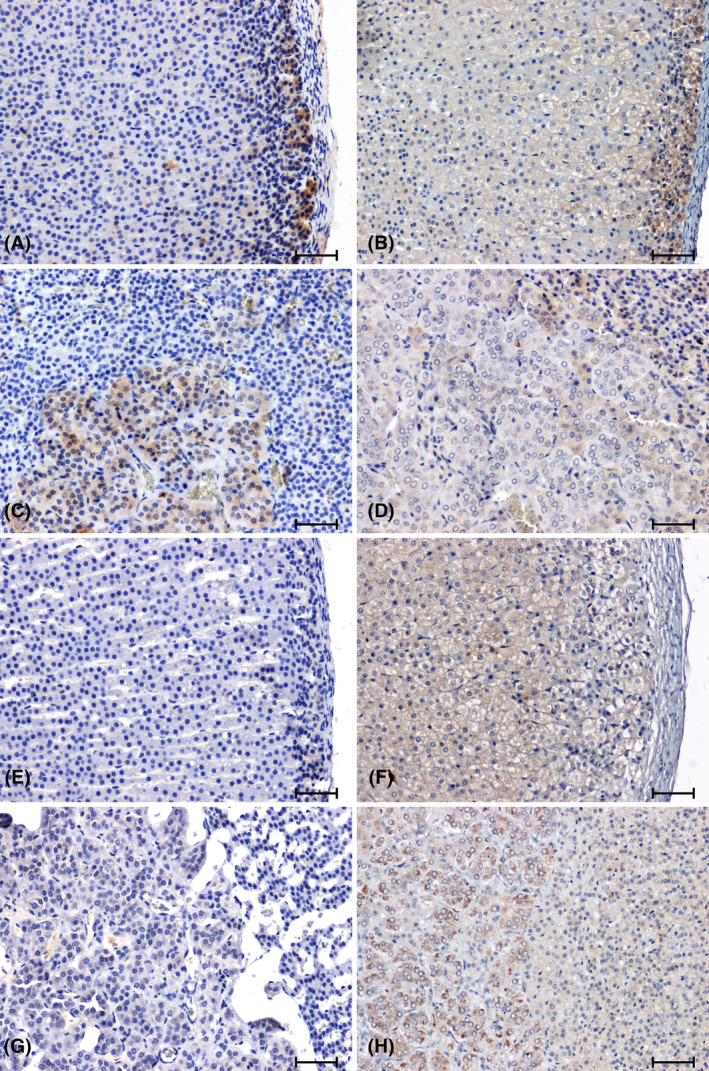 Immunolabelling of CB1 receptor in adrenal glands of normotensive (A–D) and hypertensive (E–H) rats. Adrenal cortex and medulla of WKY rat (A, C), sham operated rat (B, D); Adrenal cortex and medulla of SHR rat (E, G); 2K1C (F, H). Scale bar = 50 μm.