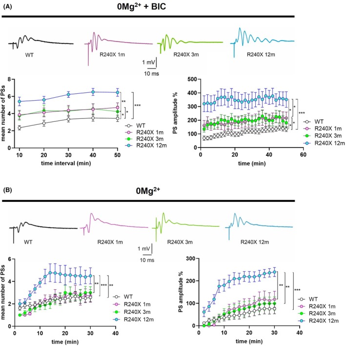 Epileptic–like activity in DG slices of 1‐, 3‐ and 12‐month‐old Epm2a R240X mice. (A) Representative traces of FPs (upper panel) and time‐course graph (lower panels) of the mean number (left) and amplitude (right) of PSs recorded in the DG of WT (black), 1‐ (pink), 3‐ (green), and 12‐month‐old (cyan) Epm2a R240X mice in a magnesium‐free ACSF in the presence of .1 μM bicuculline, showing a time‐dependent increase of the epileptic‐like activity in LD mice (PS number: WT: 3.4 ± .4, n = 21; 1m‐R240X: 4.7 ± .5, n = 8, p = .03, F (1,27)=5.2 vs WT; 3m‐R240X: 4.2 ± .6, n = 10, p = .042, F (1,28)=4.53 vs WT; 12m‐R240X: 6.5 ± .4, n = 14, p < .0001 F (1,31)=52.54 vs WT; PS amplitude: WT: 135 ± 17.9%, n = 26; 1m‐R240X: 216 ± 34.8%, n = 10, p = .046, F (1,34)=4.29 vs WT; 3m‐R240X: 182 ± 34.8%, n = 10, p = .024, F (1,35)=5.54 vs WT; 12m‐R240X: 351 ± 57.0%, n = 18, p < .0001, F (1,916) = 659 vs WT; p = .037, F (1,21)=4.96 1m‐R240X vs 12m‐R240X; p = .025, F (1,22)=5.81 3m‐R240X vs 12m‐R240X; two‐way ANOVA). (B) Representative traces of field potentials (FPs) (upper panel) and time‐course graph (lower panels) of the mean number (left) and amplitude (right) of PS measured in the DG of WT (black) and Epm2a R240X mice at 1 (pink), 3 (green), and 12 (cyan) months of age, in a magnesium‐free ACSF in the absence of bicuculline, showing the lower epileptic threshold in 12‐month‐old Epm2a R240X mice (PS number: WT: 2.6 ± .4, n = 13; 1m‐R240X: 2.7 ± .6, n = 7, p = .89 vs WT; 3m‐R240X: 3.0 ± .53, n = 8, p = .83 vs WT; 12m‐R240X: 4.5 ± .72, n = 6, p = .0012 vs WT; p < .0001 1m‐R240X vs 12m‐R240X; p = .0014 3m‐R240X vs 12m‐R240X; PS amplitude: WT: 75.8 ± 22.9%, n = 10; 1m‐R240X: 118 ± 35.8%, n = 8, p = .30 vs WT; 3m‐R240X: 99.1 ± 29.5%, n = 10, p = .46 vs WT; 12m‐R240X: 240 ± 20.3%, n = 11, p < .0001 vs WT; p = .0029 1m‐R240X vs 12m‐R240X; p = .0015 3 m‐R240X vs 12m‐R240X; two‐way ANOVA). Data are reported as means ± SEM, n refers to the number of slices.