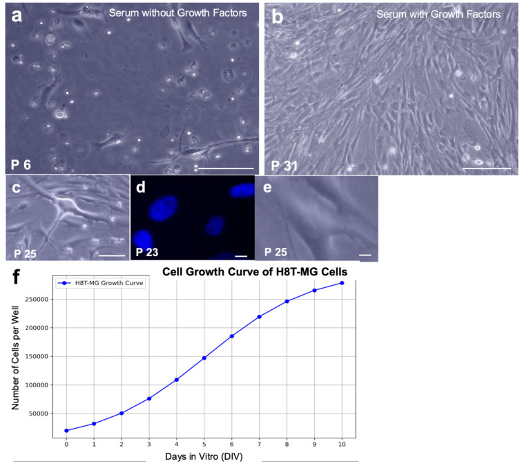 Morphological features and growth behaviour of H8T-MG meningioma cells under different culture conditions. (a) Under serum-containing, mitogen-deprived conditions, H8T-MG cells showed a senescent-like phenotype with low density, rounded morphology and loss of adhesion (P6). Scale bar: 200 µm. (b,c) Under mitogen-supplemented conditions (EGF, bFGF and LIF), cells displayed elongated spindle-shaped morphology and preserved cytoarchitecture across passages (P31, P25). Scale bars: 200 µm (b) and 40 µm (c). (d) DAPI-stained nuclei showing the characteristic elongated/oval morphology under mitogen-supplemented conditions (P23). Scale bar: 10 µm. (e) Bright-field image at the same magnification as (d), highlighting overall cell morphology and oval nuclei (P25). Scale bar: 10 µm. (f) Growth curve of H8T-MG under mitogen-supplemented conditions; estimated doubling time ~40 h.
