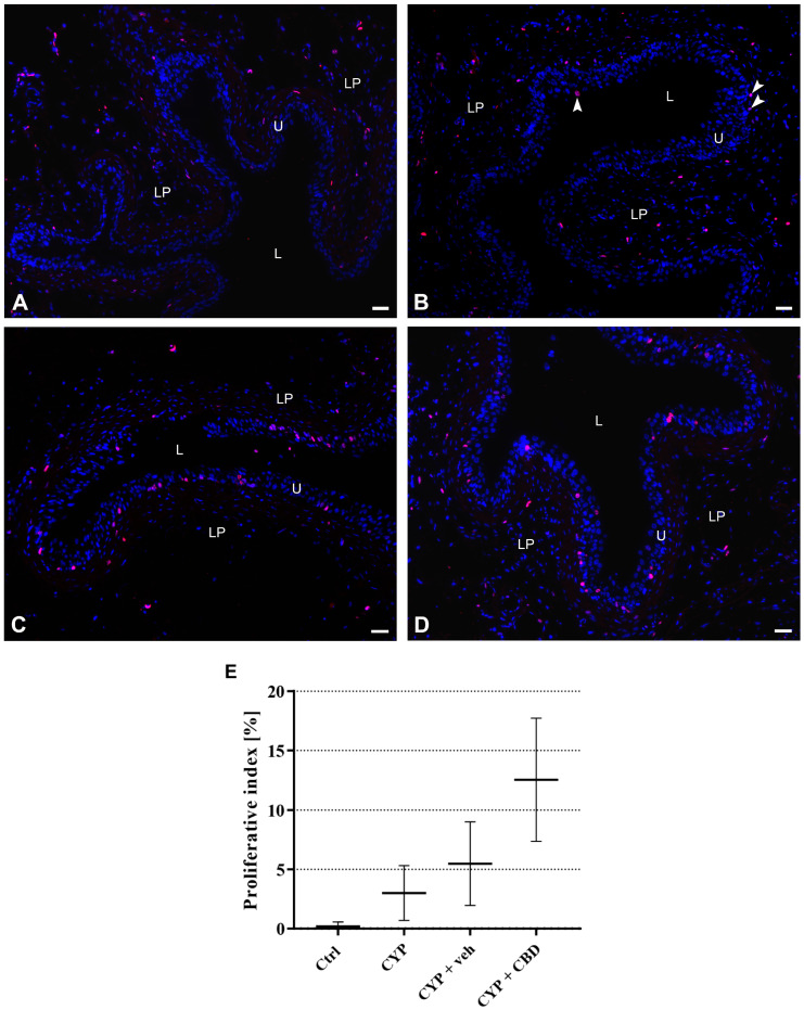 Proliferative activity of urothelial cells in the urinary bladders from all experimental groups of mice. (A–D) Representative micrographs of immunofluorescence labelling of Ki-67 (red fluorescence) and nuclear staining with DAPI (blue fluorescence). (A) No nuclei of urothelial cells with positive Ki-67 immunoreaction (pink colour due to merged red and blue fluorescence) are observed in the urothelium of the control group. (B) Only the nucleus of a superficial cell (separate arrowhead) and two basal cells (aligned arrowheads) with positive Ki-67 immunoreaction (pink colour due to merged red and blue fluorescence) are present in the urothelium of CYP-treated mice. (C) Numerous nuclei of urothelial cells with positive Ki-67 immunoreaction (pink colour due to merged red and blue fluorescence) are seen in the basal and intermediate cell layers of the urothelium of CYP + veh-treated mice. (D) Numerous nuclei of urothelial cells with positive Ki-67 immunoreaction (pink colour due to merged red and blue fluorescence) are present in all layers of the urothelium of CYP + CBD-treated mice. L—lumen of the bladder, U—urothelium, LP—lamina propria. Scale bars: (A–D) 50 µm. (E) Chart of proliferative indexes (PI) for each animal group (n = 3 per group). Data are presented as mean values and standard deviations for each experimental group of mice.