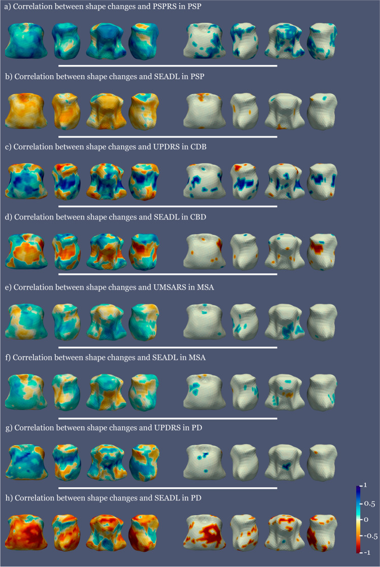 Correlation maps between clinical variables and shape atrophy in PSP, CBD, MSA, and PD compared to controls. The left column shows all the correlation values and the right column only the significant ones. Blue represents positive correlations and red negative correlations. All analyses covaried for age at inclusion