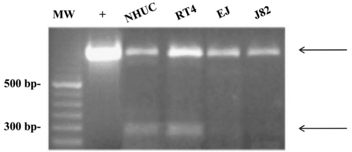 s-TRPV2 expression in human normal urothelial and urothelial carcinoma cell lines. cDNA from NHUCs and RT4, EJ, and J82 cell lines was amplified by PCR for TRPV2 expression. PCR products were analyzed by electrophoresis on 2% ethidium bromide-stained agarose gel. The hTRPV2-plasmid construct was used as positive control (+). Arrows indicate the two products obtained. MW = molecular weight.
