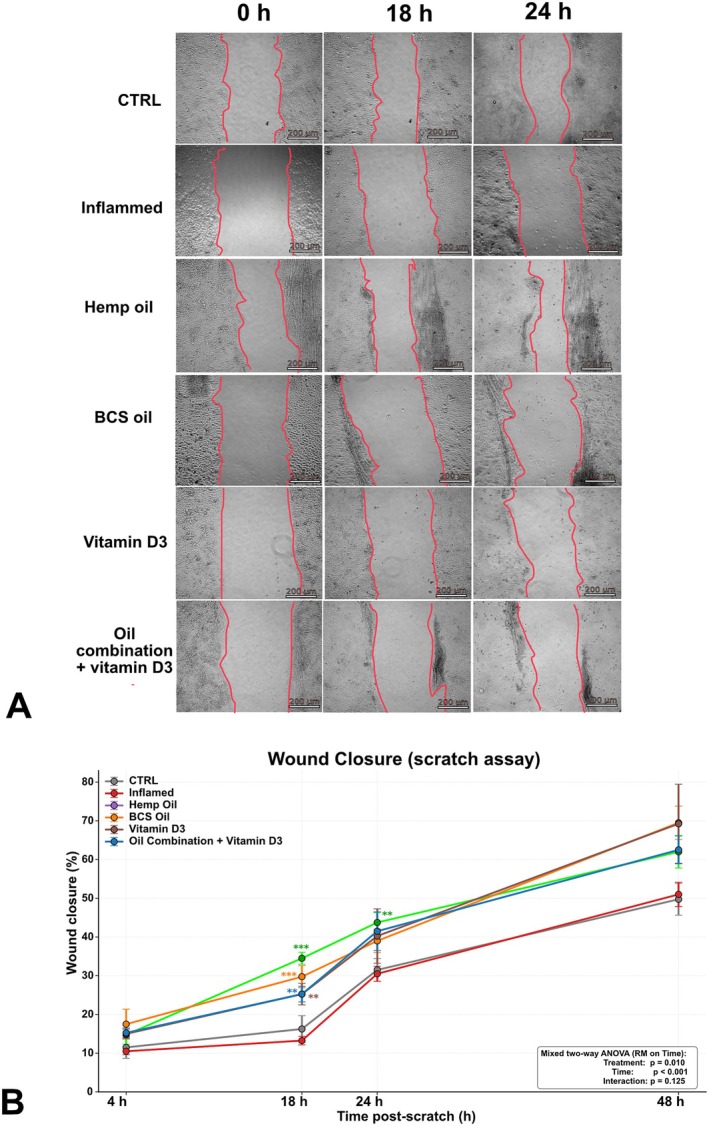 Effects of natural oil formulations and vitamin D3 on keratinocyte migration in an inflammatory scratch assay. Keratinocyte migration was assessed using a scratch assay performed in the presence of Ara‐C to suppress proliferation and isolate migration‐driven wound closure. (A) Representative phase‐contrast images of scratch wounds at 0, 18, and 24 h post‐scratch in control (CTRL), Inflamed, and treated groups (hemp oil, BCS oil, vitamin D3, and oil combination + vitamin D3). Yellow lines indicate the manually traced wound margins. Representative images at 0, 18, and 24 h are shown, corresponding to baseline and to the timepoints displaying the most pronounced between‐group differences in the quantitative analysis; the complete time course (0, 4, 18, 24, and 48 h) is reported in panel (B). Scale bar: 200 μm. (B) Quantification of wound closure (%) at 4, 18, 24, and 48 h. Data are presented as mean ± SEM (n = 4 independent scratches per condition, across three independent experiments). Statistical analysis: Mixed two‐way ANOVA with treatment as the between‐subjects factor and time as the within‐subjects (repeated‐measures) factor, followed by per‐timepoint Welch's t‐tests with Šidák correction using Inflamed as the reference. #/p < 0.05; ##/**p < 0.01; ###/***p < 0.001.