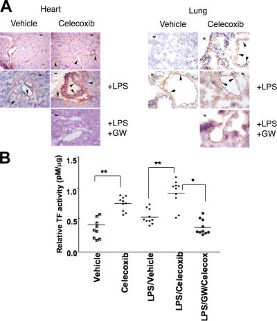 Regulation of TF expression in vivo by celecoxib and a PPARδ activator. C57BL/6J mice were treated with either vehicle (0.5% carboxymethyl cellulose), 25 mg/kg celecoxib, or 10 mg/kg GW501516 by gavage for 2 d. LPS (E. coli serotype 0111; B4; Sigma-Aldrich) was injected i.p. (100 μg/mouse). After 4–6 h, whole blood was collected from caudal vena cava into 10× acid citrate dextrose buffer to determine TF activity as previously described (see Materials and methods). Murine tissues were also harvested for immunohistochemistry. (A) Expression of TF protein in frozen tissue sections of lung and heart. Immunohistochemistry was conducted with monoclonal rat anti–mouse TF antibody and representative images are shown. The arrows and arrowheads indicate expression of TF protein in large vessels, as well as microvessels of both heart and lung. Bar, 20 μm. (B) TF activity was measured in PPP as described in Materials and methods. TF concentration was interpolated as ΔA405-490 from a standard curve. n = 10 mice/group. *, P < 0.05; **, P < 0.01.