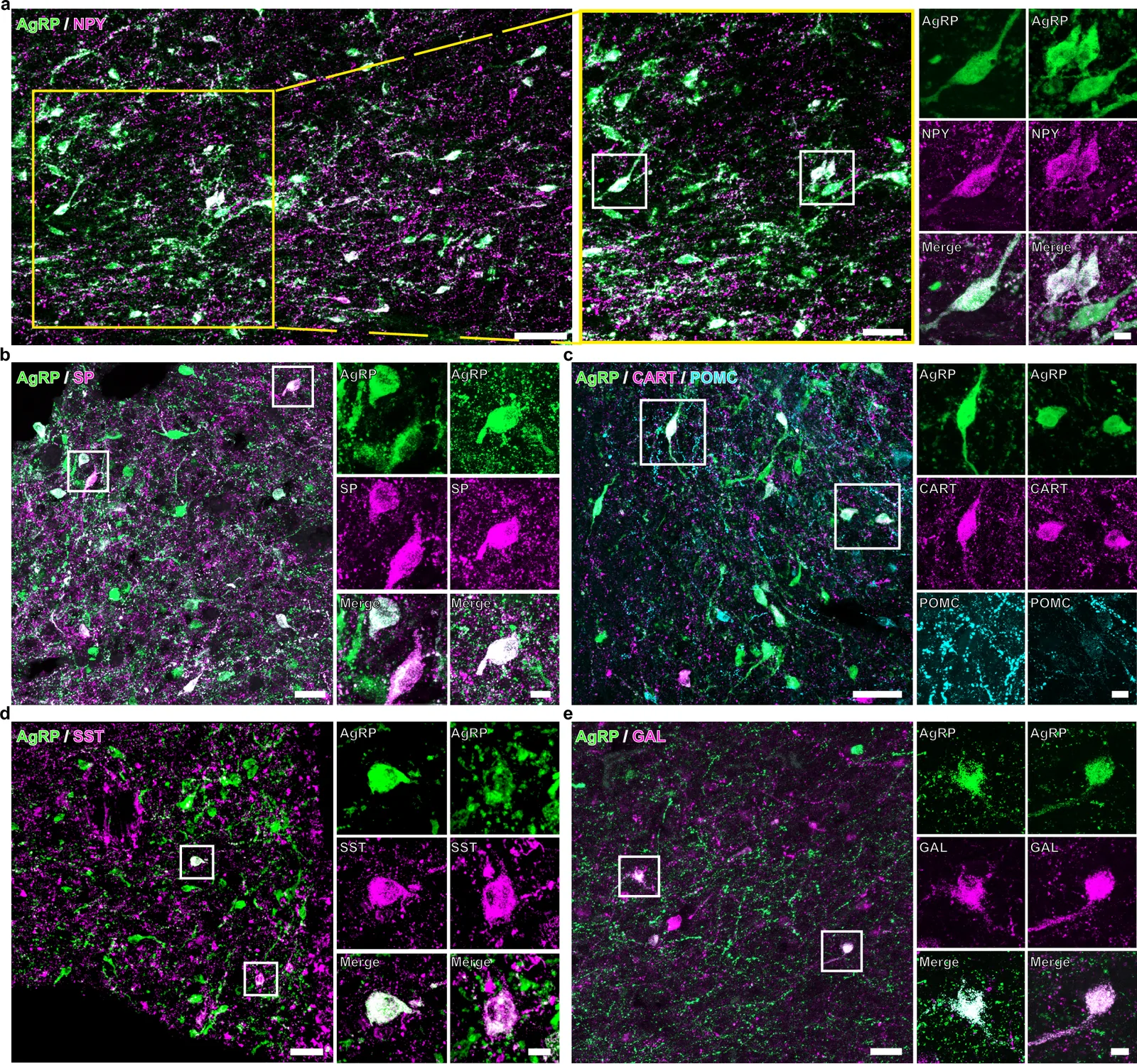 Dual-immunofluorescent validation of neuropeptide co-expression in human AgRP neurons.a–e Presence of neuropeptide Y (NPY; a), substance P (SP; b), cocaine- and amphetamine-regulated transcript (CART; c), somatostatin (SST; d), and galanin (GAL; e) labeling (magenta) in varying subsets of AgRP-IR neurons (green). Note that POMC neurons (turquoise in c) are devoid of CART immunolabeling. Medium- and high-power images magnified from the boxed areas show examples of dual-labeled neurons in separate and merged channels. Similar results were obtained in two independent experiments, each using two different biological samples. For antibodies, see Supplementary Data 8. Scale bars: 100 µm in low-power image (a), 50 µm in the medium-magnification images (a–e), and 10 µm in the high-power images enlarged from the boxed areas of preceding panels.