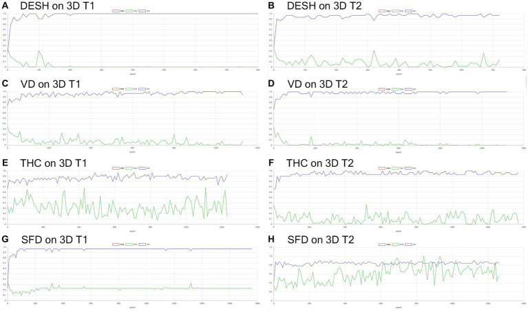 Inference results for internal validation of the image classification. The loss (green line) for the detection of disproportionately enlarged subarachnoid space hydrocephalus (DESH: A,B), ventricular dilatation (VD: C,D), tightened sulci in the high convexities (THC: E,F), and Sylvian fissure dilation (SFD: G,H) on 3D T1-weighted (A,C,E,G) and T2-weighted MRIs (B,D,F,H).