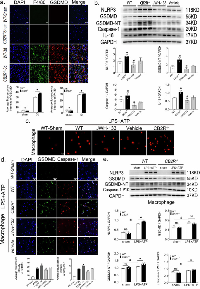 CB2R knockout exacerbates macrophage pyroptosis after skeletal muscle injury.a The average fluorescence intensity of F4/80 and GSDMD, scale bar = 20μm, n = 3, *p < 0.05 vs. WT group. b Western blot and quantitative analysis of NLRP3, GSDMD, GSDMD-NT, caspase-1 and IL-18 in each group 3 days after skeletal muscle injury, n = 3, *p < 0.05 vs. WT group, #p < 0.05 vs. Vehicle group. c PI pictures of peritoneal macrophages treated with LPS + ATP. d Immunofluorescence of caspase-1(red) and GSDMD (green), blue channel is DAPI stained nuclei, scale bar = 20 μm, n = 5, *p < 0.05 vs. WT-3d group, #p < 0.05 vs. Vehicle group. e Western blot and quantitative analysis of NLRP3, GSDMD, GSDMD-NT and caspase-1, n = 3, *p < 0.05 vs. WT group, #p < 0.05 vs. sham group. Data are represented as mean ± SD. ns no significance.