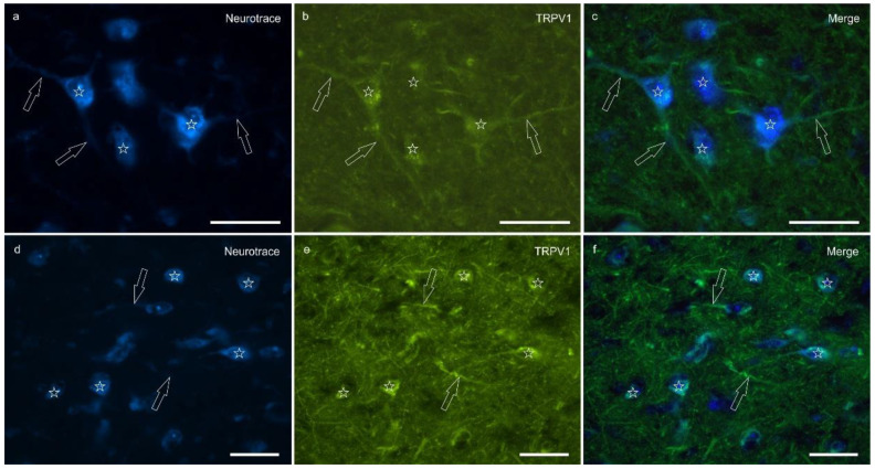 Photomicrographs of the cryosections of the lateral nucleus of the amygdala of a horse showing moderate-to-bright transient receptor potential vanilloid 1 (TRPV1) immunoreactivity (b,e) in NeuroTrace-labeled neuronal cell bodies (a,d) (stars), their nerve processes (open arrows) and the varicosities of the neuropil. (c,f) Merged image. Scale bar = 50 µm.