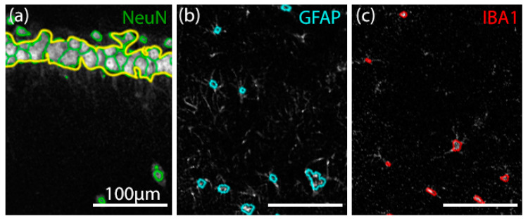 Analysis of different cell types by a cell-counter algorithm. (a) NeuN+ cells (green) with an explicitly delimited pyramidal layer (yellow), (b) GFAP+ (cyan), and (c) IBA1+ (red) cells evidentiated and contoured by our custom cell-counter algorithm. All three immunostainings are superposed in their z-stack maximum-intensity projections.