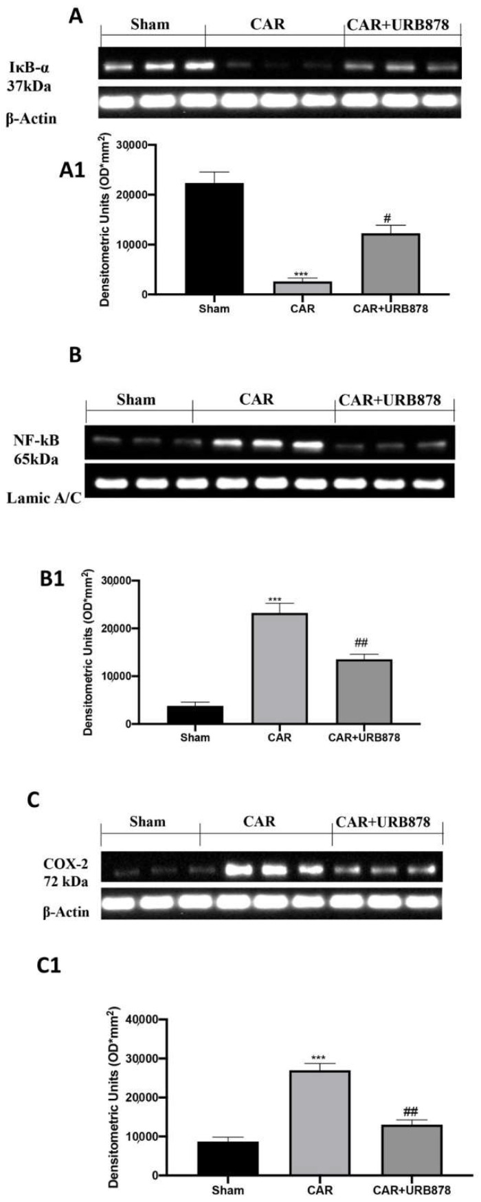 Western Blot and relative densitometric analysis for IkB-α (A,A1) NF-kB (B,B1) and Cox-2 (C,C1). Values are means ± SEM of 6 mice for all groups. See manuscript for further details. *** p < 0.001 vs. sham; # p < 0.05 vs. CAR; ## p < 0.01 vs. CAR.