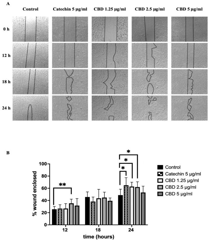 (A) Images of the wound healing assay of fibroblasts after forming gaps and being treated with CBD for 12, 18, and 24 h. (B) The bar graphs represent the percentages of wound-enclosed fibroblasts after being treated with CBD. The data are presented as the mean ± and standard deviation (±SD) from three independent experiments (n = 3). Statistical significance was determined by a one-way ANOVA (non-significant; ns, significant; * p < 0.05 and ** p < 0.01 vs. control (CBD 0 µg/mL)).