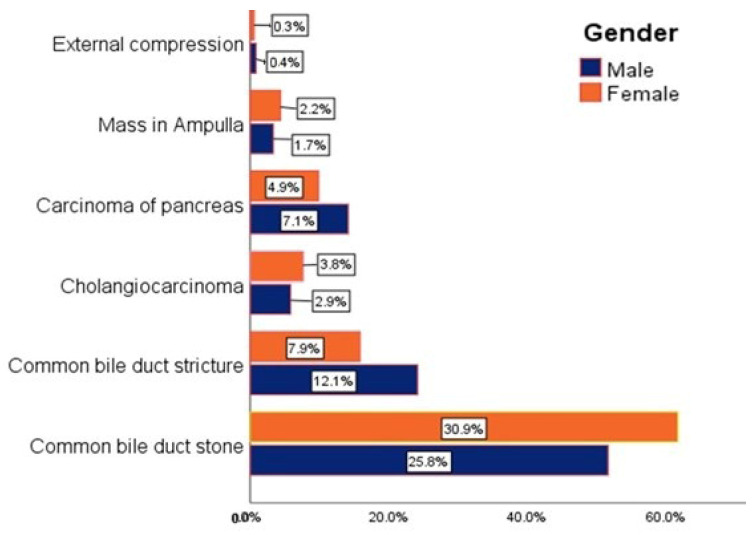 The distribution of causes of obstructive jaundice between males and females.