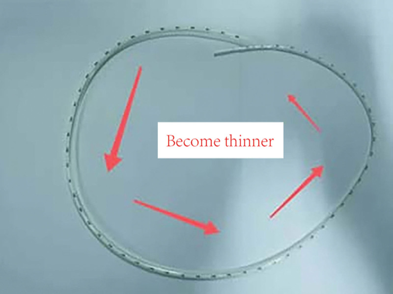 Variable diameter measurable pancreatic duct. The pipe diameter gradually becomes thinner along the arrow direction.