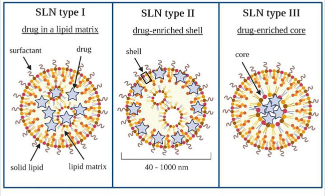 Types of solid lipid nanoparticles. Own drawing based on (206).