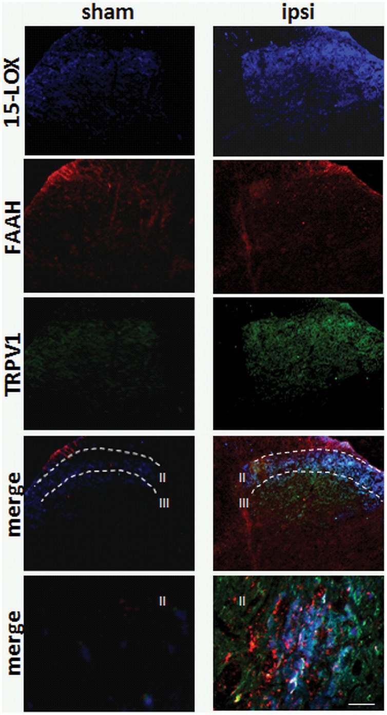 Effect of sciatic nerve CCI on 15-LOX, FAAH and TRPV1 immunoreactivities in sham operated and ipsilateral lumbar dorsal horn of the spinal cord.After sciatic nerve-CCI, a significant increase of 15-LOX/TRPV1 immunoexpression is observed especially in lamina II. FAAH immunoreactivity is located both in fibers and puncta in the cytoplasm of 15-LOX/TRPV1 neurons. Scale bar = 100 µm, and 30 µm in merged images.