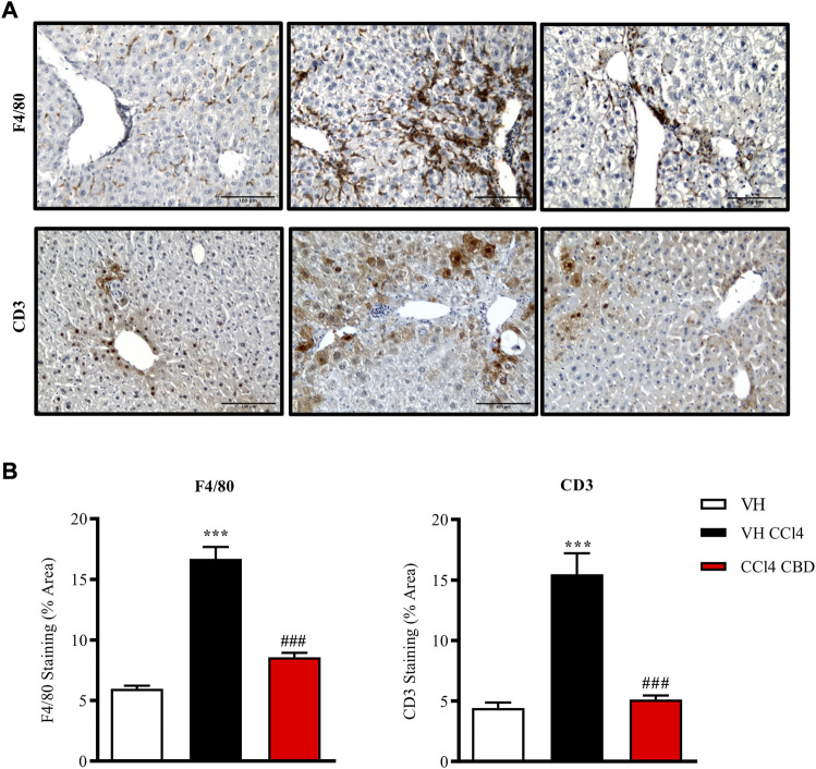 CBD reduces hepatic inflammation induced by CCl4. (A) Representative images of immunostaining for F4/80 (macrophage-specific marker; upper panel) and CD3 (lymphocyte-specific marker; bottom panel) from control, CCl4-vehicle, and CCl4 + CBD mice. Scale bars represent 100 μm. (B) Quantification of (percentage of total liver area) for F4/80 and CD3 (left and right panel respectively). Values are expressed as mean ± SEM (n = 6 animals per group). ***p < 0.001 vs. control group; ### p < 0.001 vs. CCl4 group (ANOVA followed by Tukey’s test).