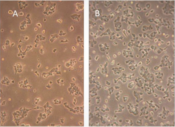 MIN6 pancreatic β-cells in culture. A) MIN6 pancreatic β-cells growing as approximately 30% confluent monolayer. B) The cells expand until they reach 60%–70% confluency, at which stage they are passaged or used for insulin secretion experiments.