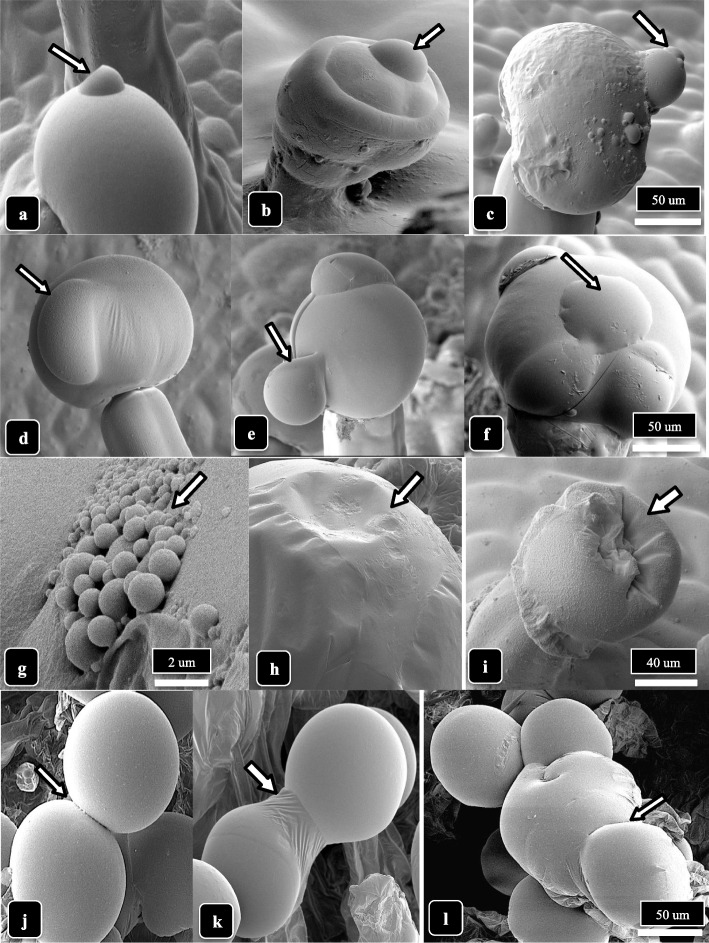 The process of resin extrusion and collapse of the capitate trichome heads is shown for cannabis genotype MD. Extrusion of resin and formation of droplets are shown by arrows. a, b Secretion from bulbous trichomes. c–e Secretion from capitate trichome heads. f Bulging of the cuticle (arrow) is due to resin secretion from the head. g–i Secretion of resin causes the cuticle to develop a central depression (arrows) and the trichome head to collapse. j–l Resin secretion causes trichome heads to stick to one another (arrows). Scale bars shown in c, f, i, l apply to the preceding images in each row