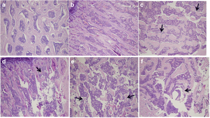 Morphological changes of bone tissue in each group were observed by HE staining (HE × 100). (a) 4w NC group. (b) 6w NC group. The bone tissue in 4w and 6w NC group is arranged in neat columns, and the bone trabecula structure is intact. (c) 4w IH group. A small amount of bone tissue is lost, their arrangement is disordered, the number is decreased, and the cells are edema. (d) 4w IH + Ri group. The trabecula structure is better than before. (e) 6w IH group. The bone tissue loss is more serious, trabecular structure is obviously damaged, the number is significantly reduced, and bone cells are highly edema. (f) 6w IH + Ri group. The destruction of bone tissue is significantly reduced