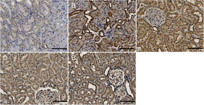 Fis1 protein expression in rat renal tissue. Immunohistochemical labelling of Fis1 in renal tissue in each group. a NC; b: 4w CIH; c: 6w CIH; d: 4w CIH + Ri; e: 6w CIH + Ri. Original magnification, × 200. Scale bars, 50 μm