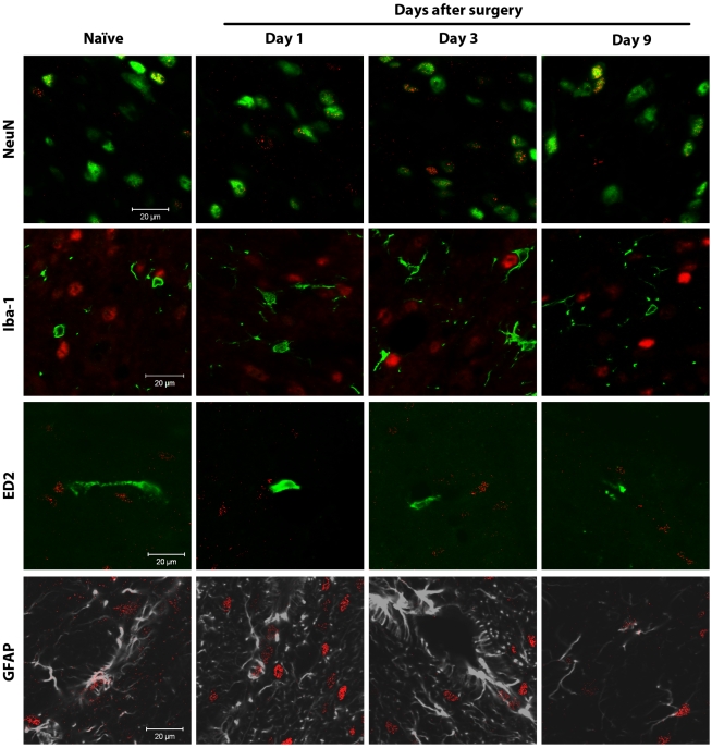 Spinal CB1 receptors are mainly expressed in neurons.Confocal analysis was used to determine spinal CB1 receptor cellular localization in the superficial laminae of the L5 dorsal horn in naïve rats or ipsilateral to surgery in rats at days 1, 3 and 9 after paw incision. Representative images are shown. CB1 receptor staining appears in red. NeuN (marker for neurons), Iba-1 (marker for microglia) and ED2/CD163 (ED2, marker for perivascular microglia) appear in green. GFAP (marker for astrocytes) appears in grey. In the images of CB1 receptors and Iba-1, CB1 receptor staining originally appeared green, and Iba-1 appeared in red. These colors were digitally switched in order to consistently represent CB1 receptor staining in red in all images. In the images of CB1 receptors and GFAP, GFAP staining originally appeared in green. The color of GFAP staining was digitally changed to grey in order to allow better visualization of occasional staining of CB1 receptors on GFAP-positive cells. The colocalization of CB1 receptors and NeuN staining appears in yellow.
