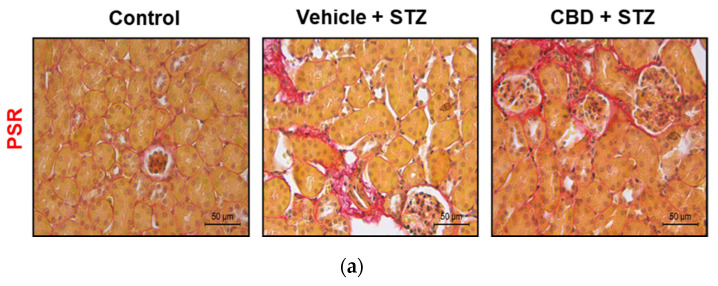 CBD does not avoid STZ-induced renal fibrosis. (a) Representative images of collagen staining of kidney from control, vehicle-STZ, and CBD-STZ-treated mice by picrosirius red dye (original magnification ×10, scale bar 50 μm). (b) Quantification of collagen positive area (expressed as a percentage of total kidney area). Values are expressed as mean ± SEM (n = 6–7 animals per group). *** p < 0.001 vs. vehicle-citrate buffer-treated mice (control).