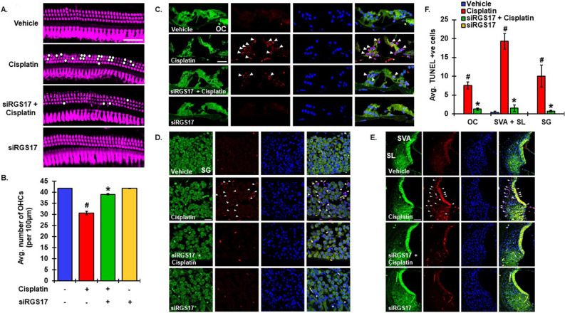 Knockdown of RGS17 inhibits cisplatin-mediated apoptosis in cochlea. (A) Male Wistar rats were pretreated with siRGS17 (0.9 μg/ear), followed by cisplatin (11 mg/kg, ip) 48 h later. Rats were sacrificed after 3 days. Cochleae were harvested, fixed, decalcified and micro-dissected and whole mount sections from the basal turns were stained with myosin VIIa (magenta). Representative images showed higher degree of damage to OHCs after cisplatin treatment, compared to siRGS17 pre-treated cochleae. Scale bar represents 25 μm. (B) Graphical representation of OHC loss showed significant decrease in number of OHCs in siRGS17 treated animals as compared to cisplatin exposed animals. Bar graphs show the average number of OHCs per 100 µm area. (C) Mid-modiolar sections were used for TUNEL staining (red) along with phalloidin immunostaining (green). TUNEL-positive cells as marked by white arrows were observed to be higher in both hair cells and supporting cells of cisplatin treated animals as compared to siRGS17 pretreated cochleae. (D) In SG neurons as well as in SVA (E), cisplatin produced greater number of TUNEL-positive cells and no distinct TUNEL-positive staining was observed in cochleae treated with siRGS17. Scale bar represents 50 µm (SVA) and 25uM (OC and SG). (F) Bar graph from TUNEL assay presented in (C,D,E) showed significantly higher number of TUNEL positive cells in animals after cisplatin exposure whereas it significantly decreased in animals pretreated with siRGS17. Data are presented as mean ± SEM. #p < 0.01 versus vehicle, *p < 0.01 versus cisplatin, N ≥ 4, one-way ANOVA (B) and two-way ANOVA (F).