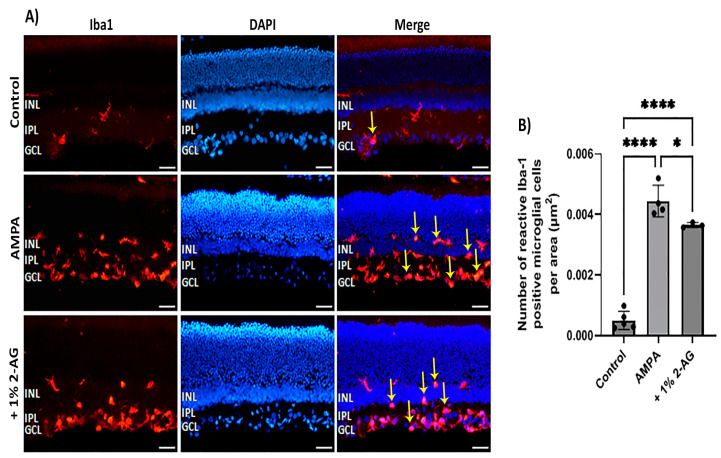 Effects of topical administration of 2-AG on AMPA excitotoxicity-induced microglial activation. (A) Representative images of Iba-1 (red) and DAPI (blue) IHC staining in the retina of control rats and rats treated with AMPA (8.4 mM, I.V.T.) and AMPA + 2-AG (1%, eye drops, 4 d). Yellow arrows depict reactive microglial cells. Yellow arrows depict reactive microglial cells. Magnification: ×20. Scale bar: 50 μm. (B) Quantitative analysis of the number of reactive Iba-1+ microglial cells in the area containing INL, IPL and GCL. Data are expressed as the mean ± SD (n = 3–5); * p < 0.05, **** p < 0.0001.