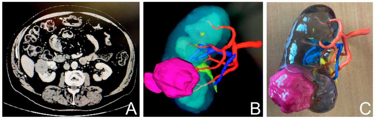 3D printed model workflow: a/CT-scan,b/ 3D model rendering, c/3D printing