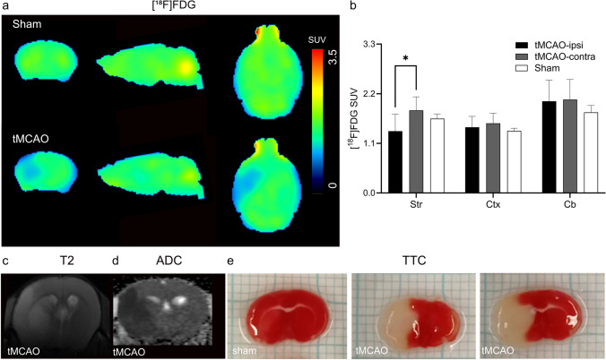 In vivo MRI and [18F]FDG PET in tMCAO mouse brain. a Representative PET images of coronal, sagittal and horizontal mouse brain sections after intravenous injection of [18F]FDG in sham-operated and tMCAO mice. The radiosignals were averaged from 21 to 61 min; b [18F]FDG accumulation (SUV) at different mouse brain regions (Str: striatum; Ctx: cortex; Cb: cerebellum) in sham and tMCAO mice. Significantly reduced [18F]FDG accumulation was observed in the ipsilateral striatum compared to contralateral side in tMCAO mice; c–e in vivo T2-weighted image, ADC map, and ex vivo TTC stained brain sections, indicating the delineation in tMCAO mice. TTC, 2,3,5-triphenyltetrazolium chloride; ADC, apparent diffusion coefficient; SUV, standard uptake value. *p < 0.05.