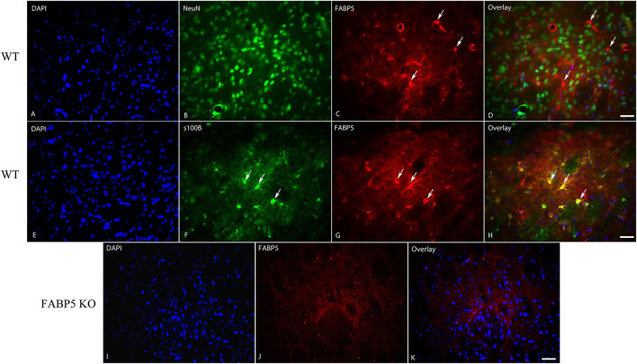 Cellular distribution of FABP5 in the dorsal striatum. Immunolocalization of FABP5 in the striatum of WT mice. Staining for DAPI (A), the neuronal marker NeuN (B), FABP5 (C), and overlay (D). Note the minimal colocalization of FABP5 in NeuN labeled neurons (arrows). Staining for DAPI (E), the astrocyte marker S100β (F), FABP5 (G), and overlay (H). Note that there is robust colocalization between FABP5 and S100β (arrows), indicating that FABP5 is expressed in astrocytes. Immunostaining was conducted on striatal sections from three WT mice and representative images are shown. (I–K) The lack of FABP5 immunoreactivity in the striatum of FABP5 KO mice. Scale bar = 20 μm.