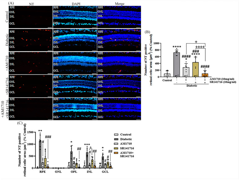 Effect of cannabinoid treatment on nitrative stress induced by diabetes in rat retina. (A) Representative photomicrographs of NT immunoreactivity (NT-IR). Magnification: 20×. Scalebar: 50 μm. (B) Quantification studies of NT-IR: Diabetes significantly increased the number of NT+ (**** p < 0.0001 compared to Control). eAM1710 reduced the number of NT+ cells in the diabetic retina (#### p < 0.0001 compared to diabetic untreated animals, * p = 0.0360 compared to Control), and SR141716 had a similar effect (### p = 0.0004 compared to diabetic untreated, **** p < 0.0001 compared to Control, p > 0.05 compared to AM1710). The dual treatment AM1710 + SR141716 reversed to Control levels the diabetes-induced increase in nitrative stress (#### p < 0.0001 compared to diabetic untreated, p > 0.05 compared to Control, + p = 0.0243 compared to AM1710, ++++ p = 0.0001 compared to SR14176). (C) Quantification studies of NT-IR in separate retinal layers. Diabetes increased NT-IR in RPE (** p < 0.0010), OPL (* p < 0.0161), INL (*** p < 0.0006), and GCL (* p < 0.0258) compared to Control. AM1710 reduced NT-IR in RPE (# p < 0.0177), OPL (# p < 0.0498), INL (# p < 0.0237), and GCL (# p < 0.0451) compared to diabetic untreated. SR141716 displayed a statistically significant effect in reducing NT-IR in GCL (# p < 0.0187). The dual treatment fully reversed elevated NT-IR in RPE (### p < 0.0002), OPL (## p < 0.0013), INL (## p < 0.0033), and GCL (## p < 0.0037), compared to diabetic untreated. Data are expressed as mean ± S.D and presented in a form that combines a bar diagram and scatter dot plot, with every dot representing a different value. One-way ANOVA was employed for the statistical analysis of data on panel (B), followed by Tukey’s multiple comparison test. Two-way ANOVA was employed for the analysis of separate layers’ NT-IR on panel (C), followed by Sidak’s multiple comparison test. Statistical significance, p < 0.05. Differences were considered statistically significant when p < 0.05.